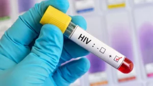 HIV Cure Getty Images